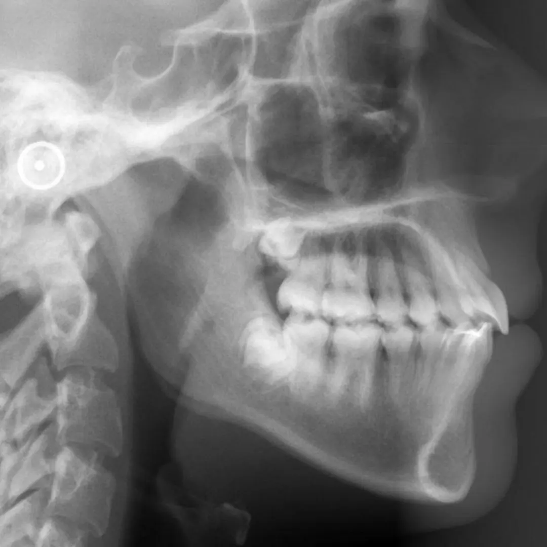 ATM-odontologia-compressed