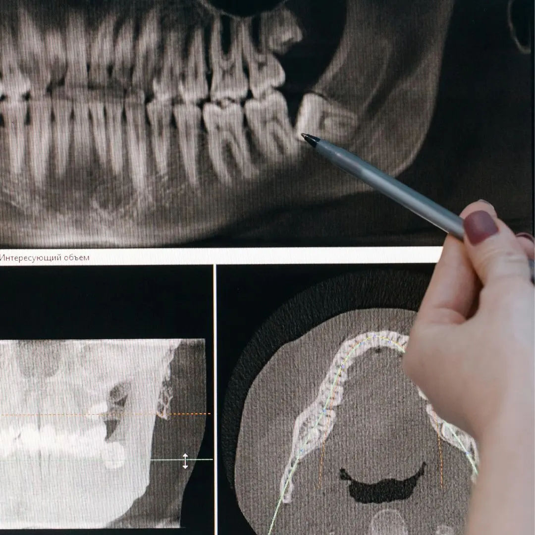 cirugia-oral-compressed (1)