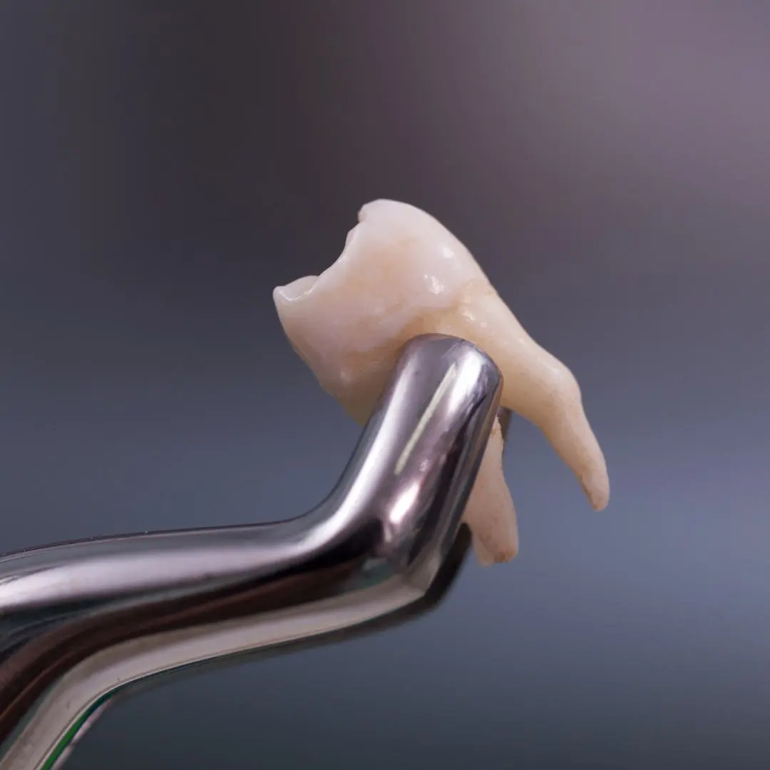 cirugia-oral-muelas-compressed